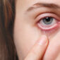 diabetic eye treatment