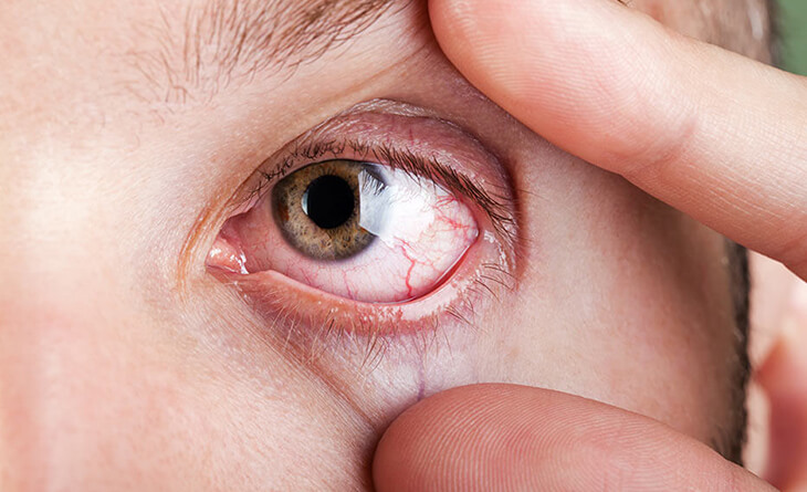 Screen time for eyes